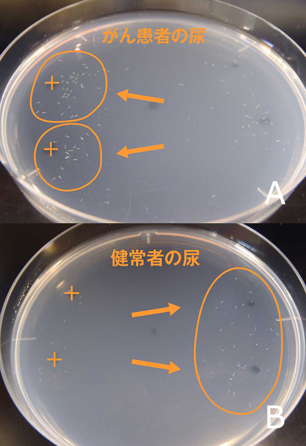 尿1滴で 線虫が早期がんを嗅ぎ分ける 95 8 という驚きの高感度 Think Blog Japan