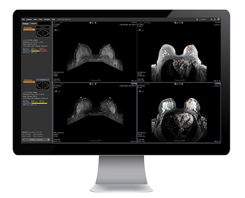 Opkon mri40ar60hld. Interventricular Flow MRI Artifact. Efilm Lite как сделать боковую проекцию. Efilm Digital Laboratories.